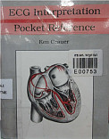 ECG interpretation pocket reference